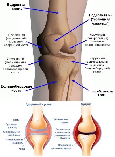 Медиальный мыщелок