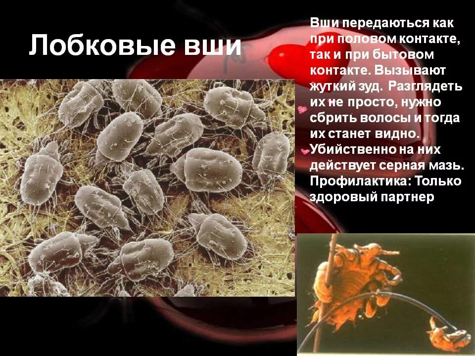 какое заболевание вызывают вши