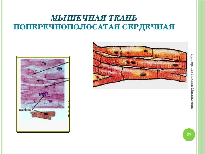 Сердечная мышца представлена тканью. Поперечнополосатая и гладкая мышечная ткань. Схема строения сердечной поперечнополосатой мышечной ткани.. Поперечнополосатая Скелетная мышечная ткань препарат рисунок. Поперечно полосатая мышечная ткань гистология.