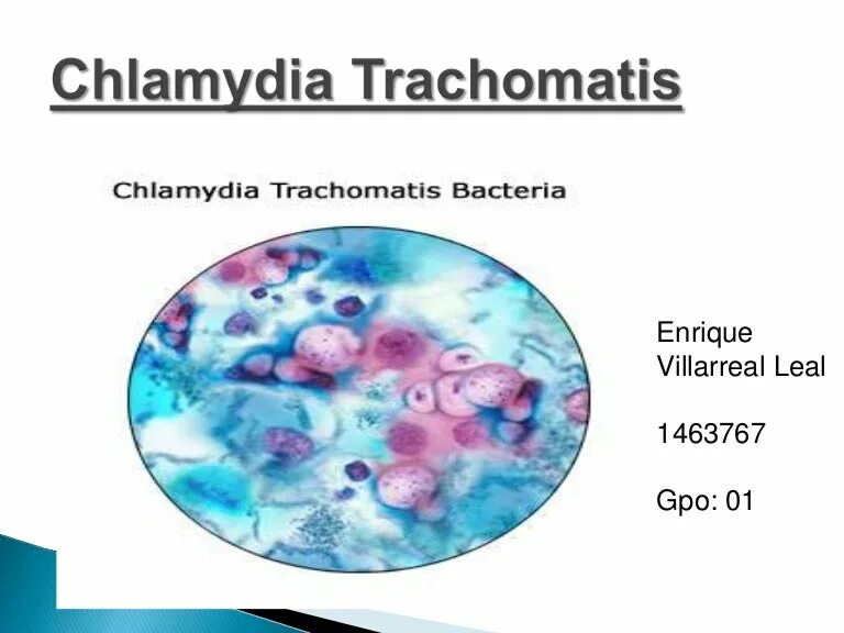 Chlamydia trachomatis. ДНК хламидии трахоматис. Хламидия трахоматис 1.50++.