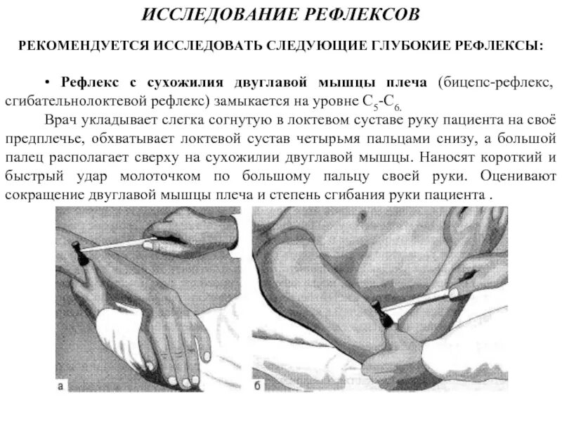 Как проверить рефлексы. Исследование рефлекса сухожилия двуглавой мышцы плеча. Сгибательно-локтевой (бицепс-рефлекс) рефлекс. Сухожильные рефлексы трицепс. Сухожильный рефлекс двуглавой мышцы плеча.