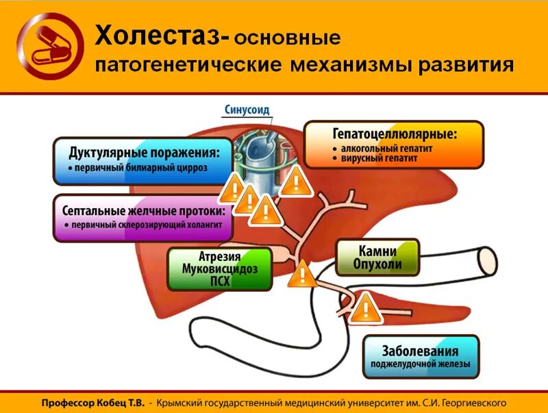 Холестаз это простыми словами. Синдром внутрипеченочного холестаза симптомы. Внутри печёночный холестаз. Синдром холестаза печени. Синдром холестаза механизм формирования.