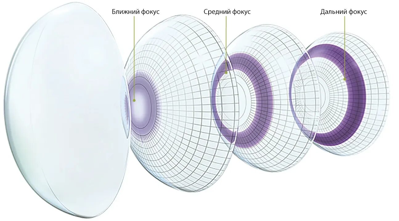 Air Optix Plus HYDRAGLYDE Multifocal 3pk. Линзы Air Optix HYDRAGLYDE мультифокальные Plus. Мультифокальные линзы Alcon Multifocal. Линзы moist Multifocal -6. Аир зрение