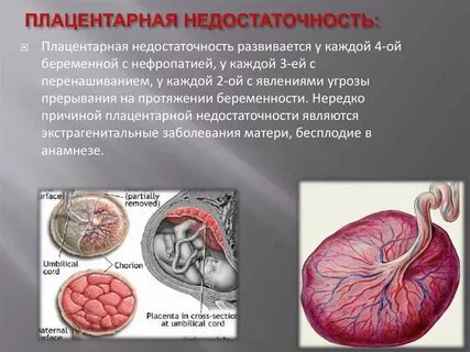 Причины плацентарной недостаточности