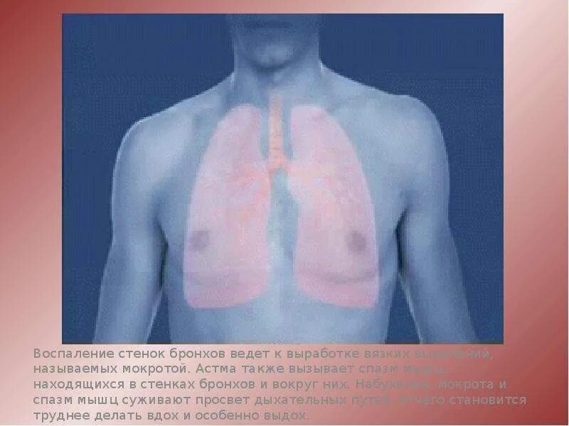 Бронхиальное раздражение