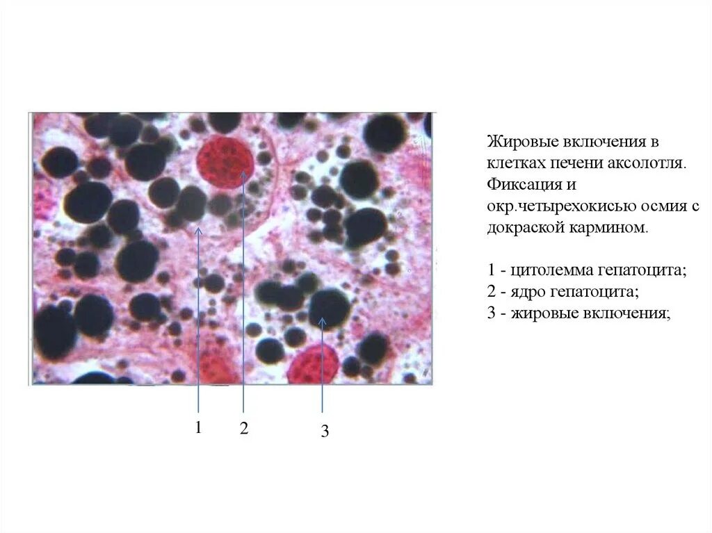 Жировые включения в клетках печени аксолотля. Общая морфология клетки гистология препарат. Жировые включения препарат гистология. Препарат жировые включения в клетках печени аксолотля.