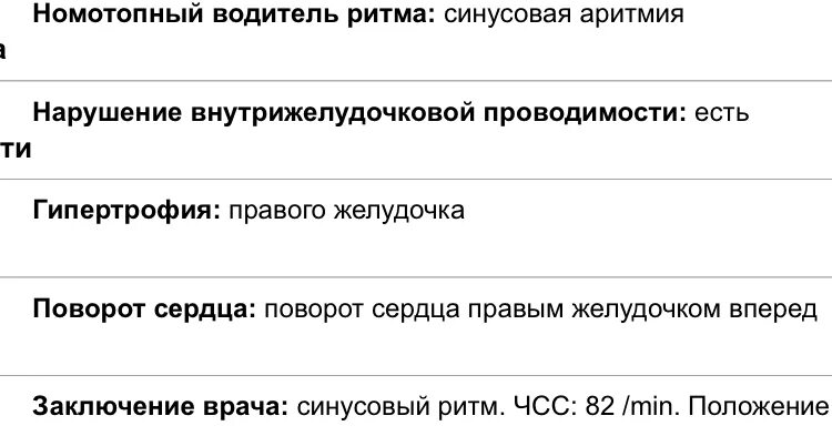Номотопный водитель ритма синусовая аритмия что это такое. Синусовая аритмия на экг расшифровка. Что значит номотопный водитель ритма. Классификация нарушений сердечного ритма. Что значит номотопный водитель ритма.