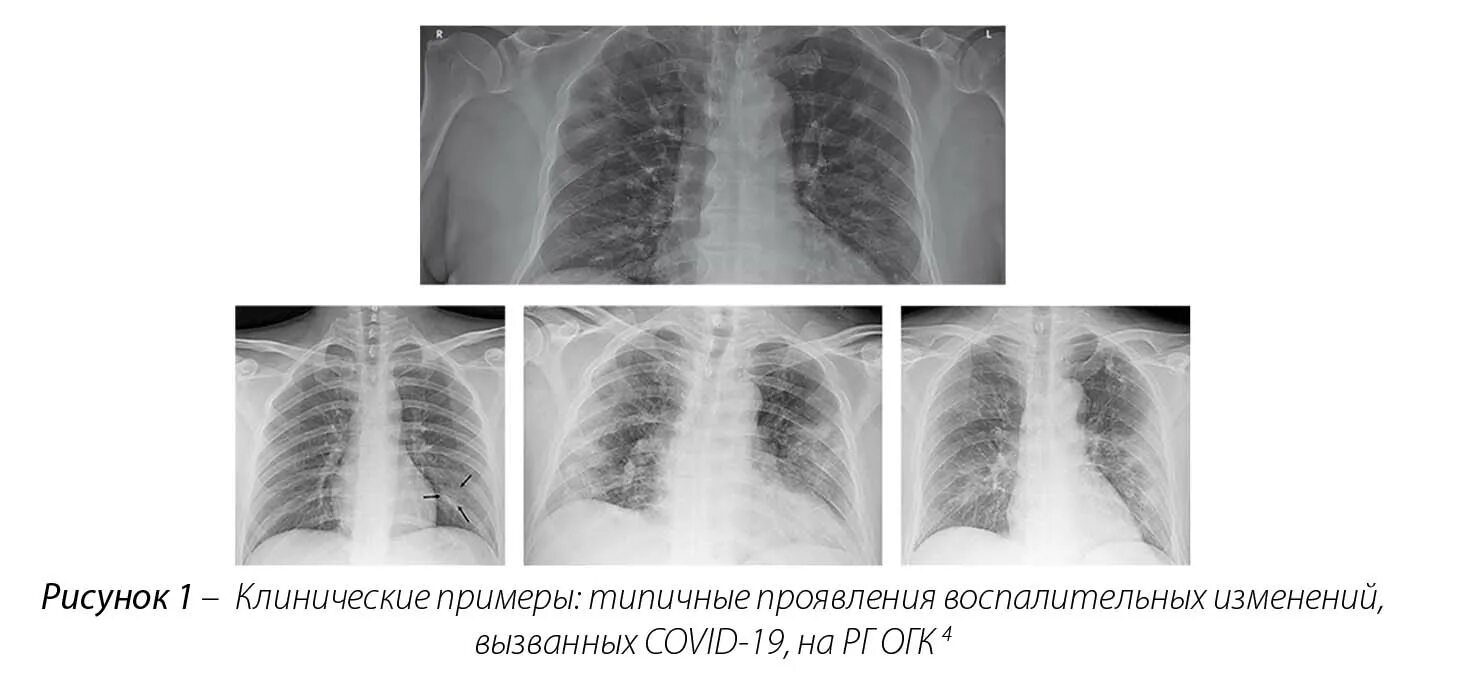 Типы организационных изменений. Ковид изменение. Виды изменений в организации. Волна коронавируса 2021 в россии. Коронавируса потеря обоняния.