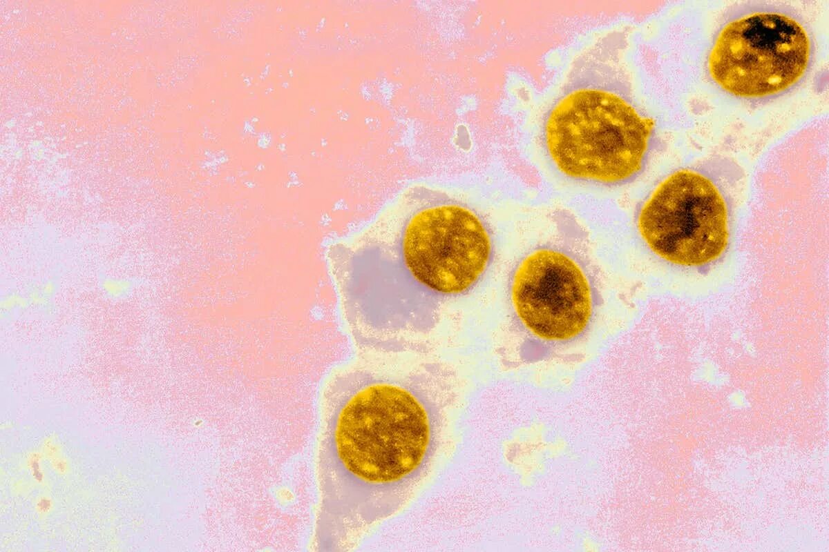 Chlamydia trachomatis. Бактерия хламидия трахоматис. Хламидия трахоматис под микроскопом.