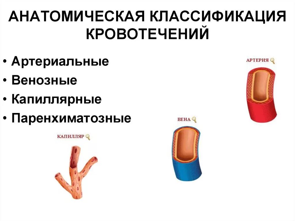 Кровотечения бывают следующих видов ответ. Классификация кровотечений по виду поврежденного сосуда. Классификация артериальных кровотечений. Классификация наружных кровотечений. Классификация кровотечений смешанное кровотечение.