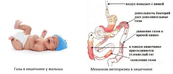 От чего бывают колики. Кишечник у новорожденного ребенка. Колики в животе у ребенка новорожденных. Колики в кишечнике у новорожденного ребенка. Кишечные колики грудничков.