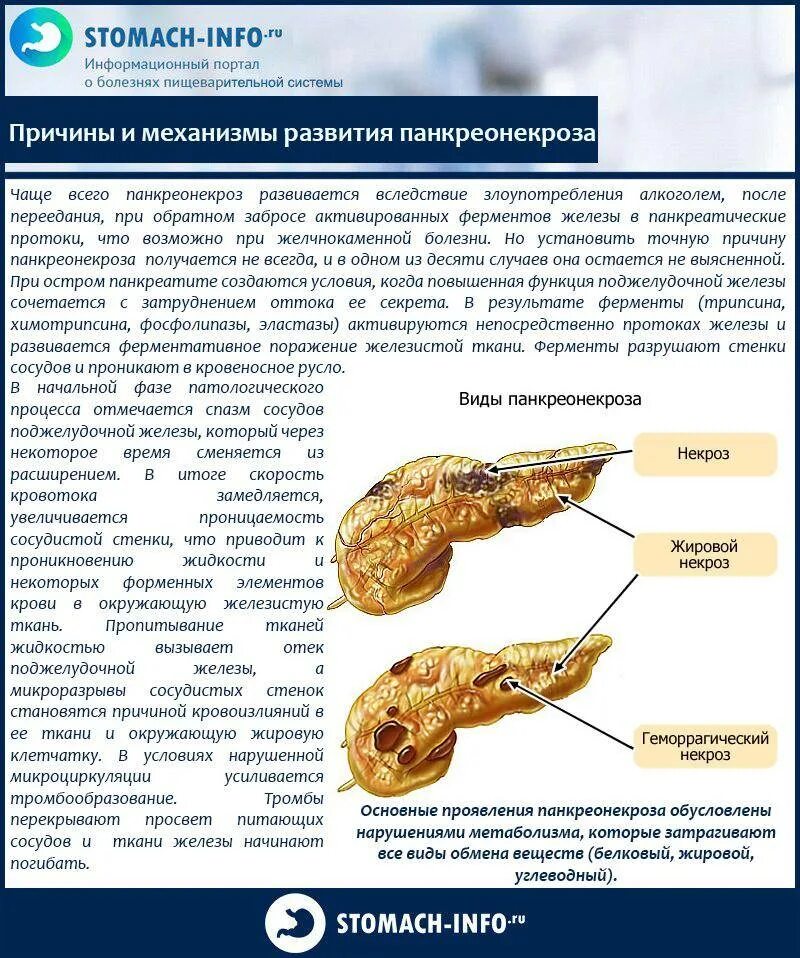 Панкреатит симптомы у мужчин и лечение препараты. Симптомы поражения поджелудочной железы. Симптомы внешние симптомы болезни поджелудочной железы. Клинические признаки поражения поджелудочной железы. Поджелудочная железа симптомы забо.