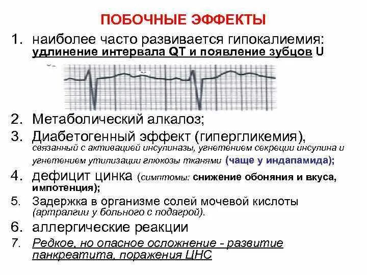 Синдром удлиненного qt на ЭКГ. Синдром удлиненного интервала qt на ЭКГ. Нормальный интервал qt на ЭКГ норма. Синдром удлинения qt на ЭКГ. Удлиненное qt у ребенка