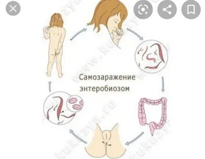 Как делать энтеробиоз дома ребенку