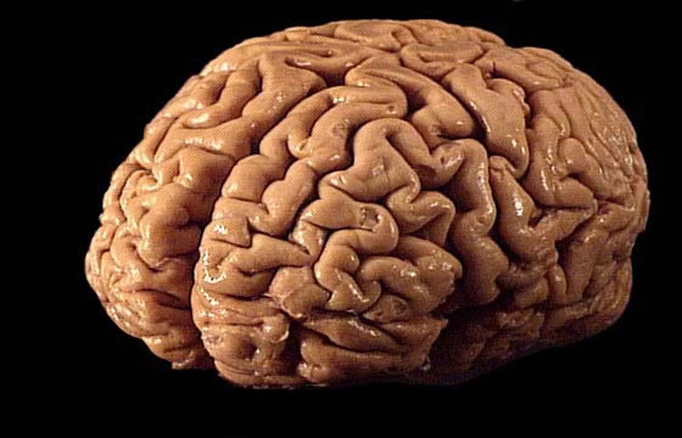 Изображение мозга.