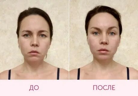 Вес лице