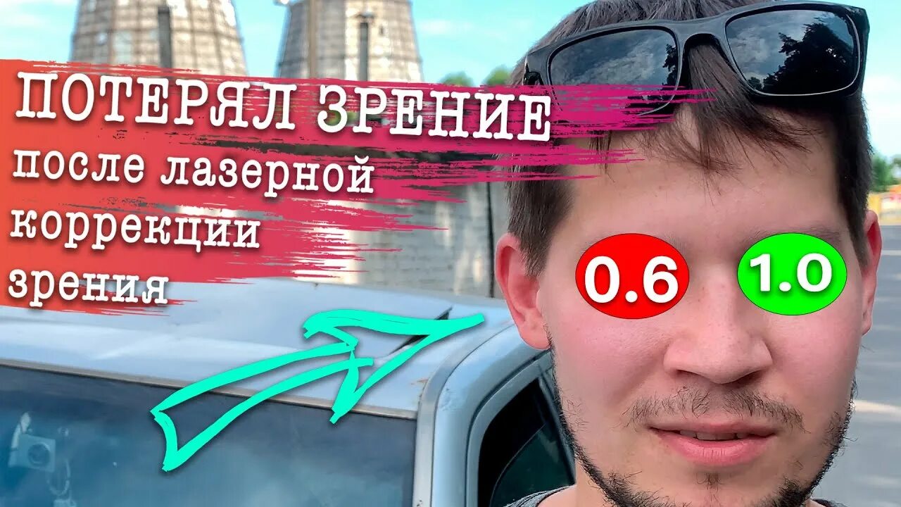 Какую лазерную коррекцию выбрать