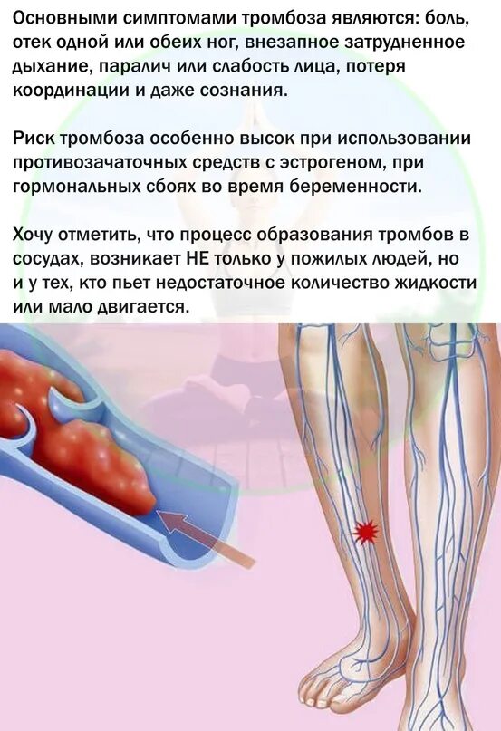 Симптомы образования тромба в ноге. Тромб причины образования. Признаки образования тромбов. Симптомы образования тромба