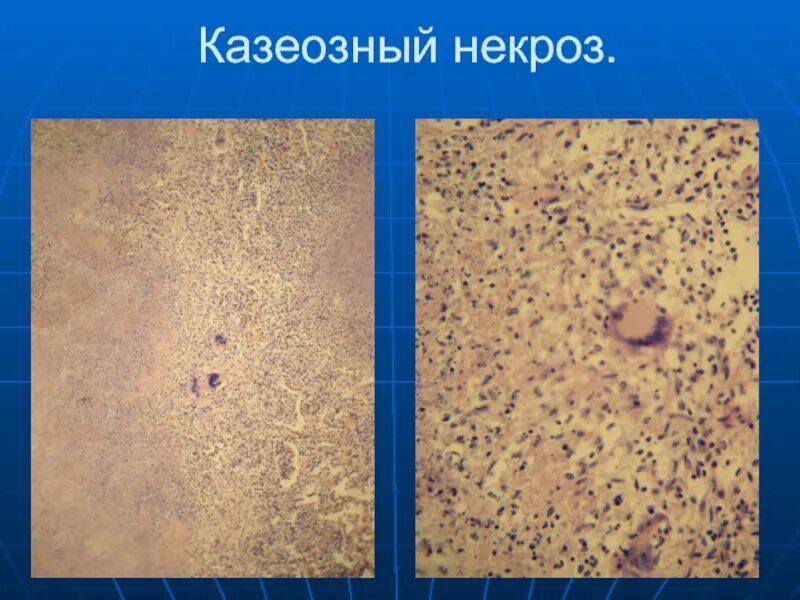 Диабетическая стопа карта вызова