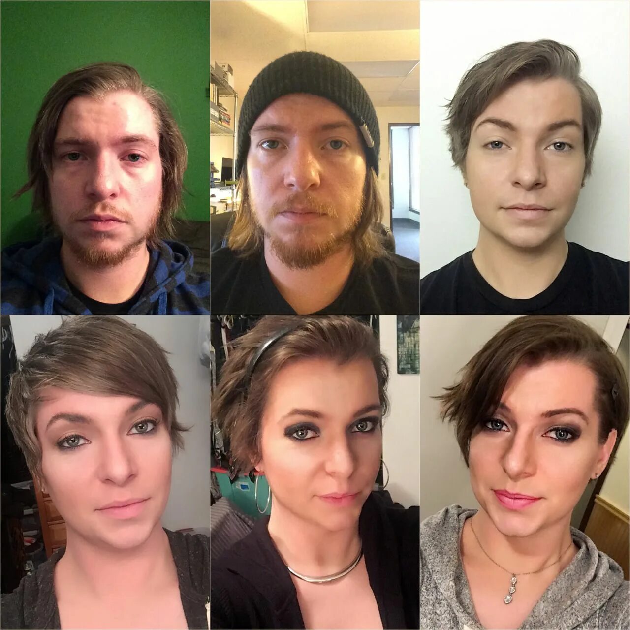 Mtf янтарная. Mtf hrt ffs. Mtf hrt 6 months. Mtf hrt 40 лет. 0 для камри 50.