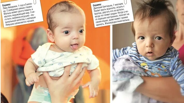 Остеопетроз мраморная болезнь. Диана голицына гид. Остеосклероз мраморная болезнь. Остеопетроз плакат. Чувашский остеопетроз.