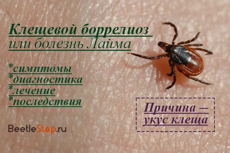 Клещевой боррелиоз клещ. Иксодовый клещевой боррелиоз диагностика. Иксодовый клещевой боррелиоз эритемная. Клещ у человека симптомы и лечение