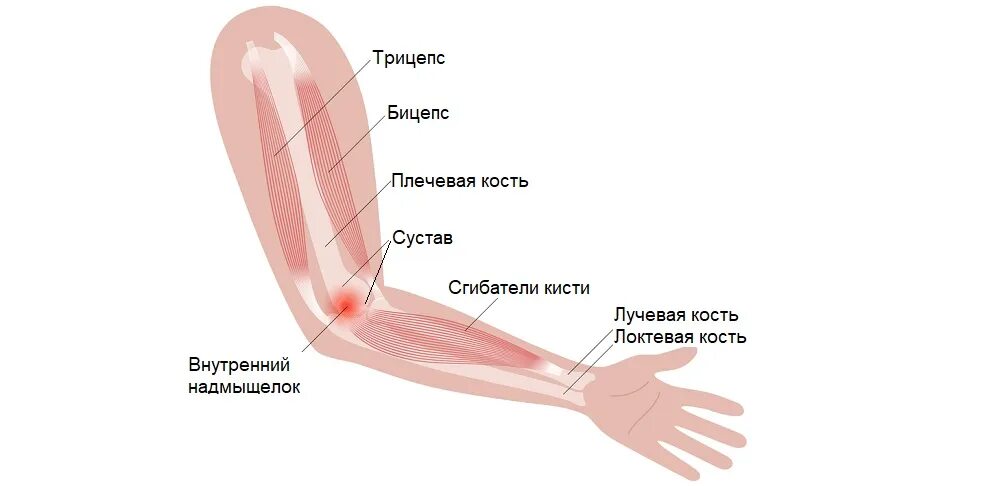 Почему болят локтевые сгибы. Эпикондилит блокада локтевого. Предплечье внешняя сторона. Внутренняя сторона локтя. Боль в локте с наружной стороны.