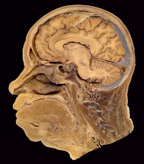 Голова срез. Голова срез. Голова срез. Сагиттальный распил головы человека. Голова срез.