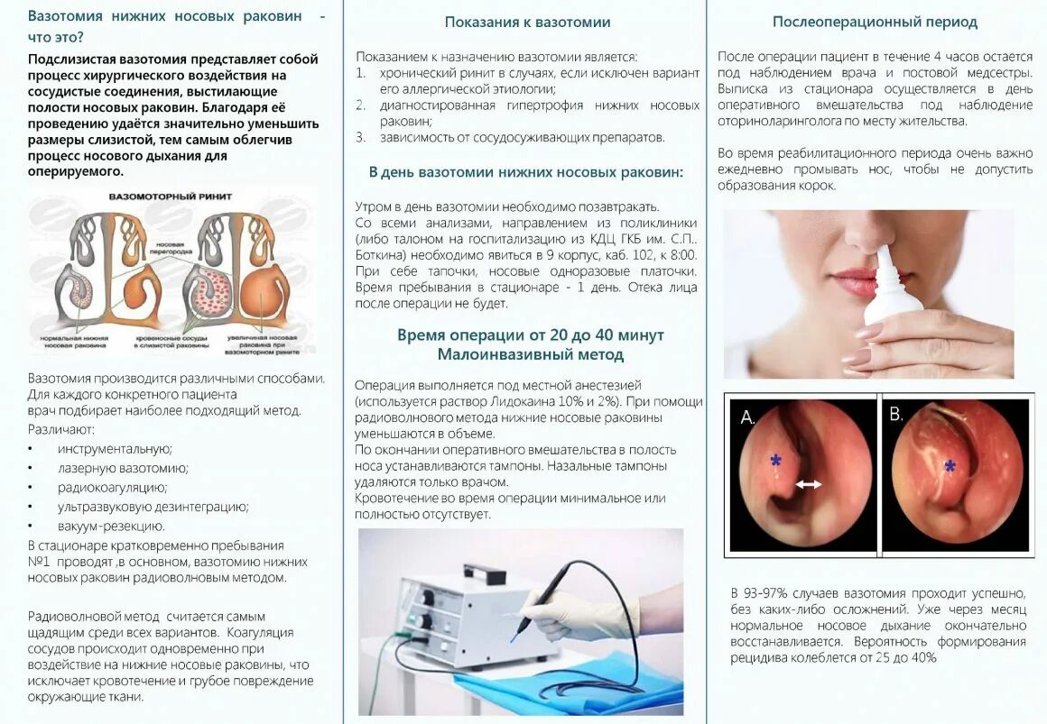 Истории болезни ринит. Подслизистая радиокоагуляция нижних носовых раковин это. Вазомоторный ринит ультразвуковая дезинтеграция. Лазерная коагуляция нижних носовых раковин. Радиоволновая дезинтеграция нижних носовых раковин.