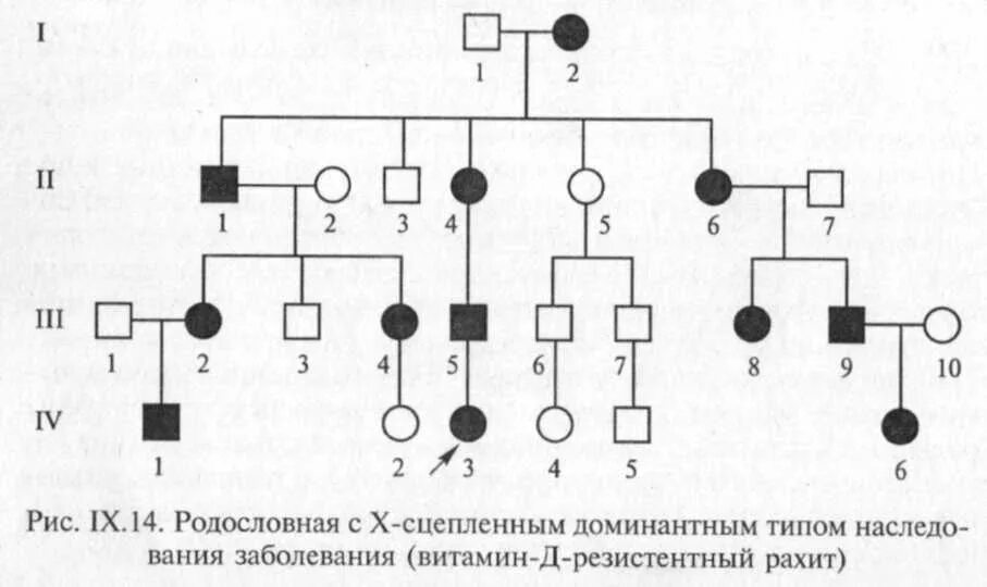 Родословная с х-сцепленным доминантным типом наследования. Х сцепленный доминантный Тип наследования. X сцепленный доминантный Тип наследования родословная. X сцепленный доминантный Тип наследования болезни.