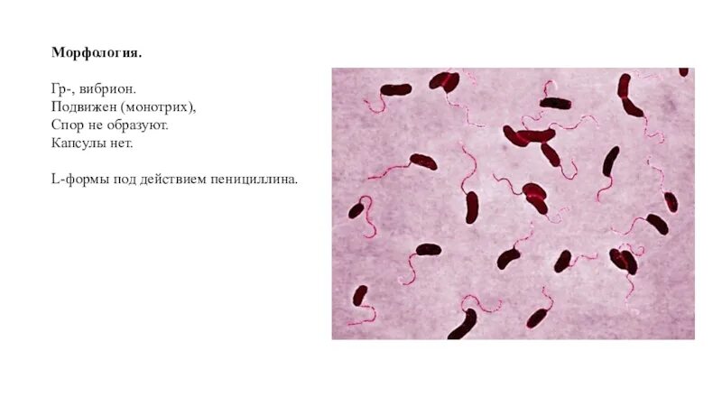 Известно что холерный вибрион вид подвижных. Vibrio cholerae морфология. Vibrio cholerae окраска по Граму. Холерный вибрион монотрих. Vibrio cholerae микробиология.