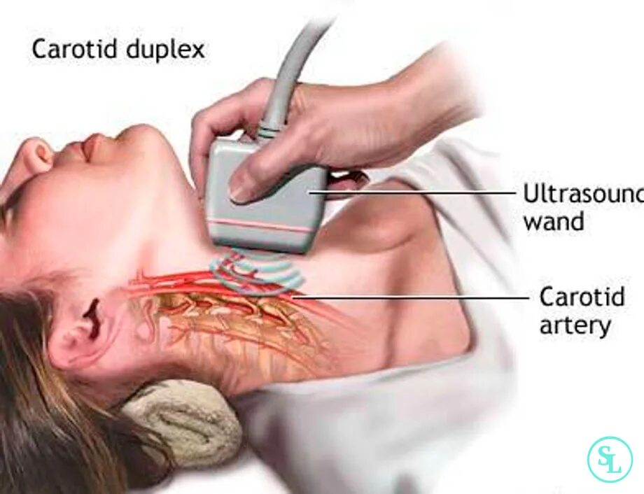 Ультразвуковая допплерография экстракраниальных сосудов. Ультразвуковая допплерография сосудов головного мозга. Ультразвуковая допплерография позвоночных артерий. Ультразвуковая допплерография сосудов шеи. Бцс что это за обследование