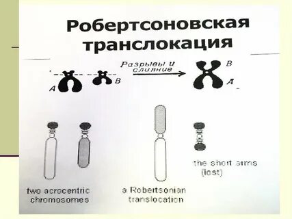 Транслокация 15 хромосомы на 15