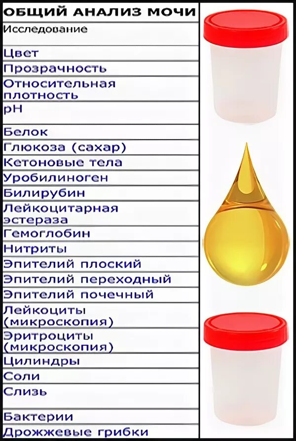 Моча прозрачного цвета как вода. Показатели мочи при цистите у женщин. моча при цистите цвет. моча при цистите у женщин цвет. анализ мочи цвет.