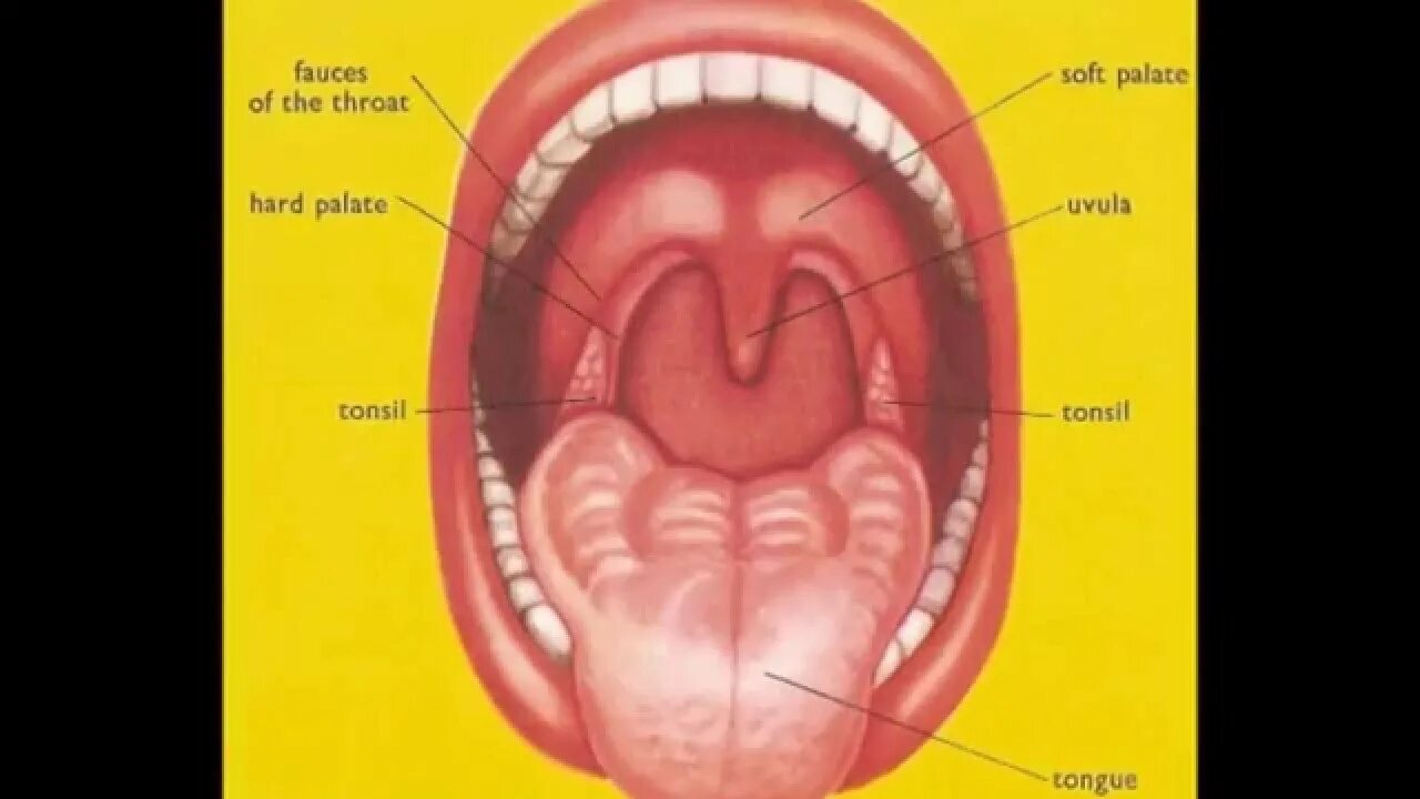 What are Tonsils and Adenoids (Sore throat pain) in children? Tonsils Adenoids T