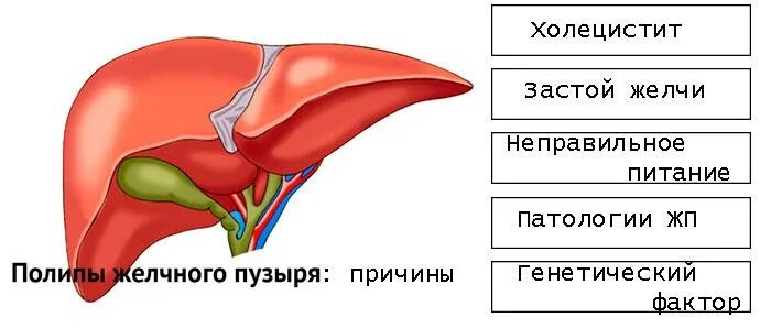 Заполнен желчный пузырь. Причины застоя желчи в желчном. Микрополипоз желчного пузыря.