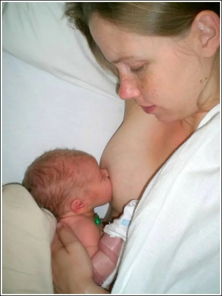 захват груди при гв. подготовка к кормлению. лактостаз. застой молока в протоках. плоские соски.