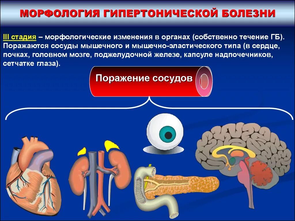 Морфологические изменения болезни. Изменения сосудов при гипертонической болезни. Морфологические изменения при злокачественной гипертензии. Структурные изменения сосудов при гипертонической болезни. Какие типы сосудов поражаются при гипертонической болезни.