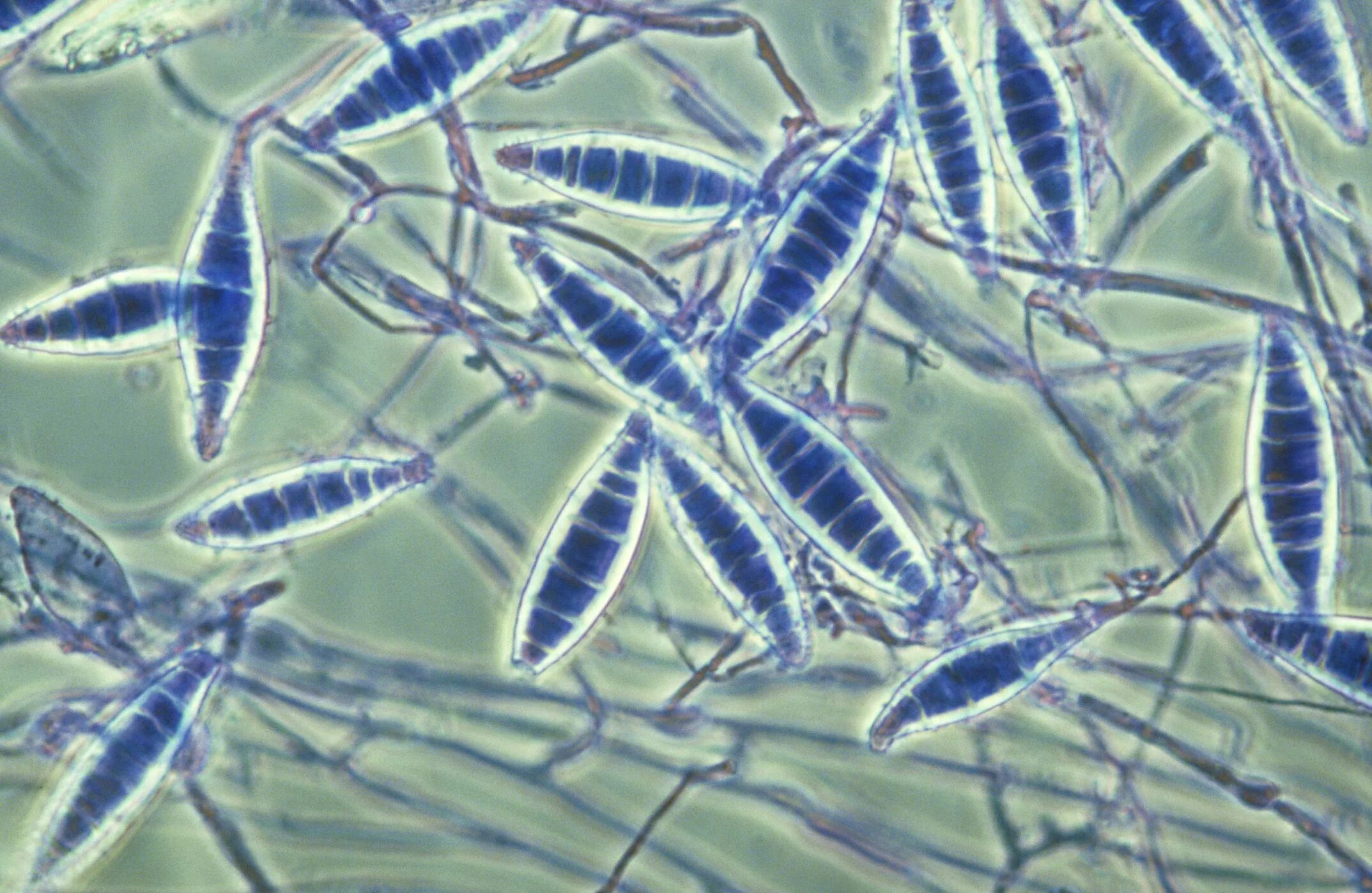 Как выглядит лишай под микроскопом у человека Pin on Microbiology