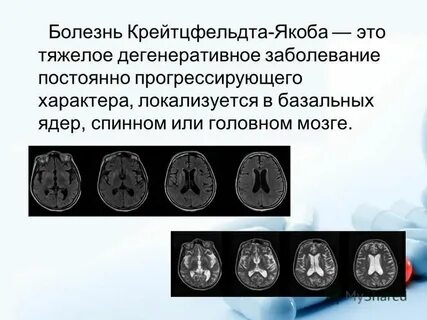 Болезнь всегда