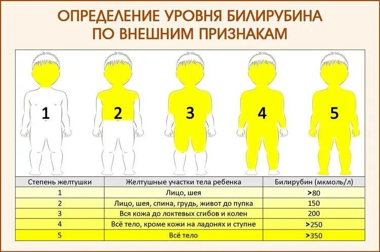 Уровень билирубина при желтухе новорожденных. Норма билирубина у новорожденных таблица по дням. желтушка у новорожденных норма. от желтухи может ребенок не набирать вес.