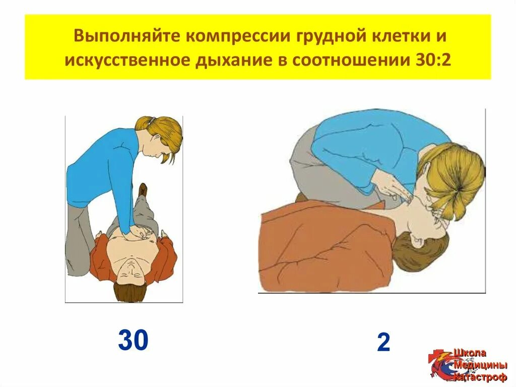 Руки в замок при сердечно легочной реанимации. Соотношение компрессий на грудину и искусственного дыхания. Соотношение грудных компрессий и искусственных вдохов. Соотношение компрессии грудной клетки вдохов искусственного дыхания. Давление на грудину при проведении сердечно-легочной реанимации.