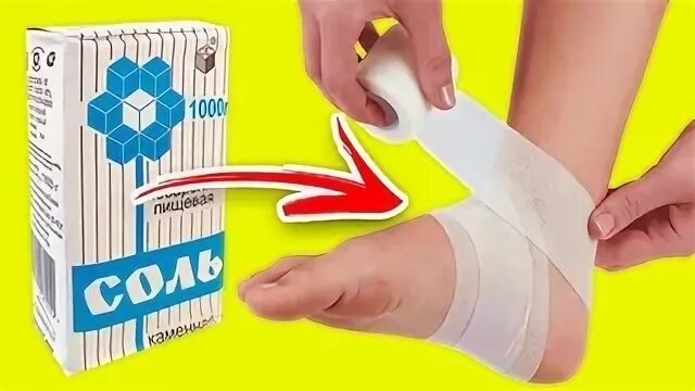 Лечение солевыми повязками
