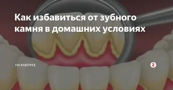 High stone как удалить