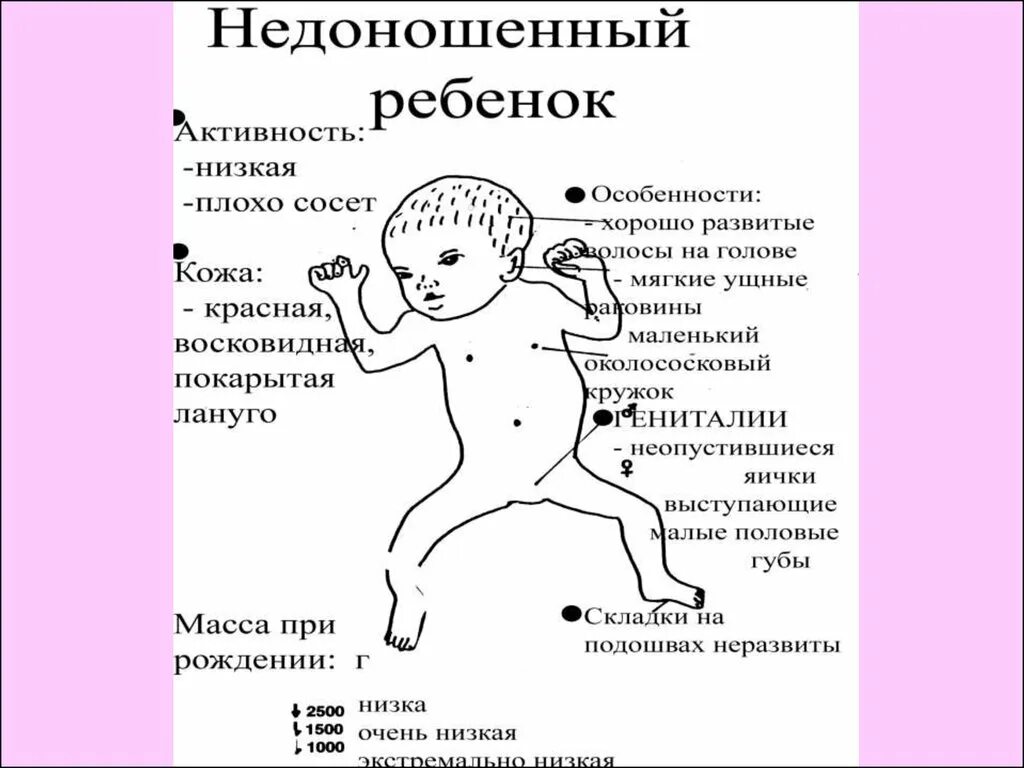 Педиатрия в таблицах и схемах. Дифф диагностика бронхообструктивного синдрома. Педиатрия схемы. Плакаты педиатрия. Витамин д рахит патогенез.