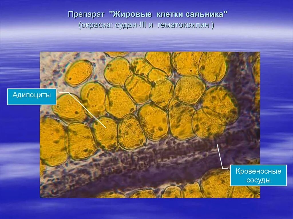 Жировые включения в клетках соединительной ткани. Жировая ткань Судан 3 гематоксилин. Окраска жировой ткани гистология. Белая жировая ткань Судан 3 гематоксилин.