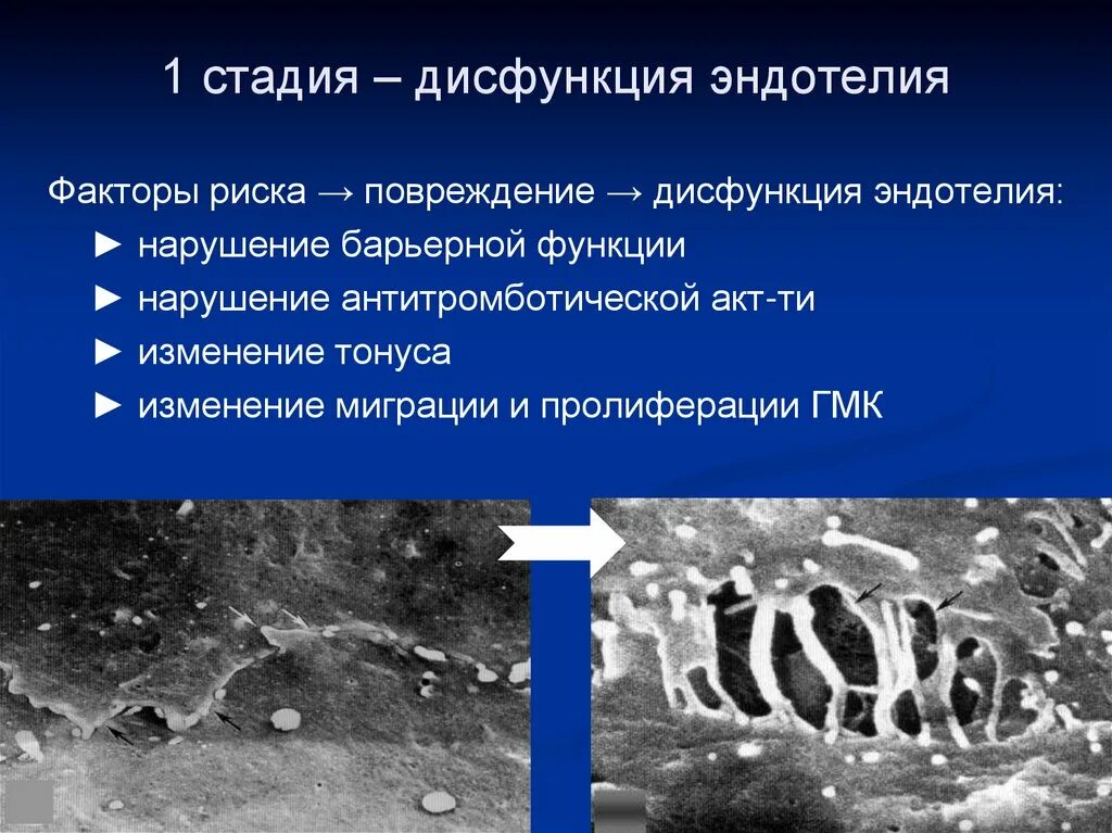 Стадии дисфункции. Стадии дисфункции