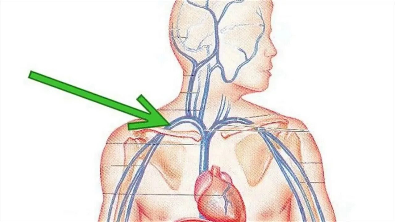 Подключичная Вена топография. Яремная и подключичная Вена. Подключичная Вена анатомия. Подключичная Вена топографическая анатомия. Правая подключичная вена