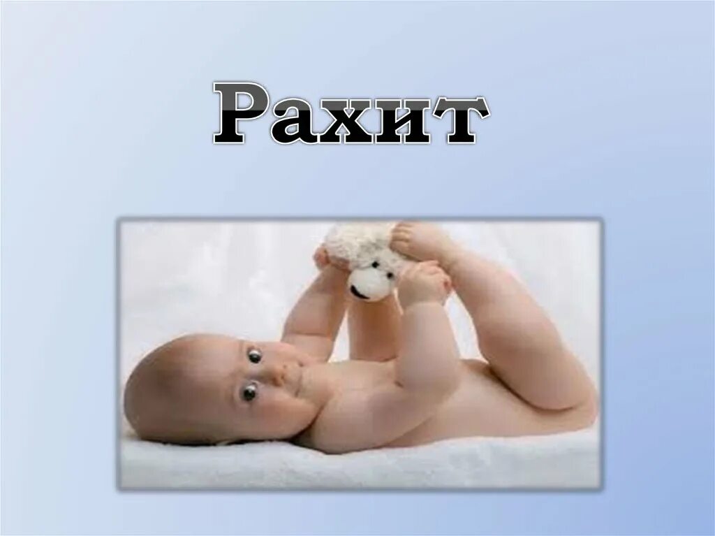 Рахит 6 лет. Профилактика рахита. профилактика рахита у детей. рахит памятка.