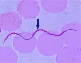 Трепонема романовскому гимзе. Боррелия по романовскому гимзе. Borrelia романовский гимза. Боррелия по романовскому гимзе. Боррелия возбудитель возвратного тифа.